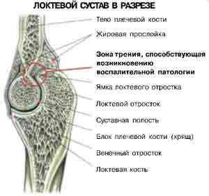 Упражнения Боли в локтях при жимах лежа